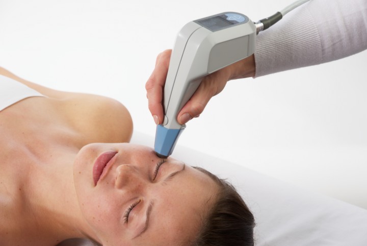 Exilis Skin Tightening Mill Valley