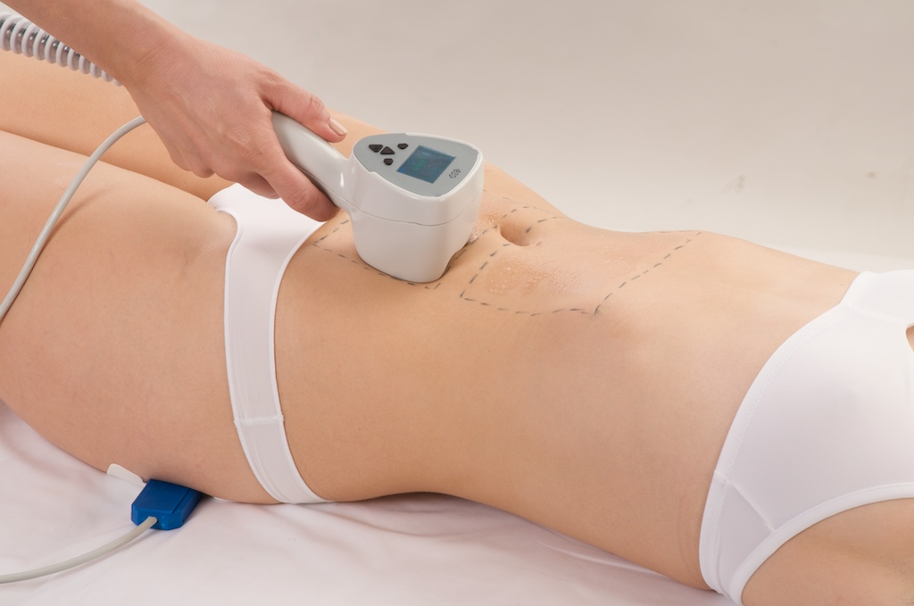 Exilis Body Contouring