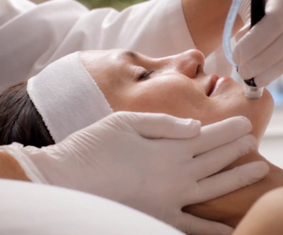 SilkPeel Microdermabrasion