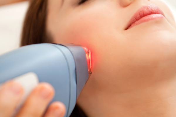 IPL Photofacial